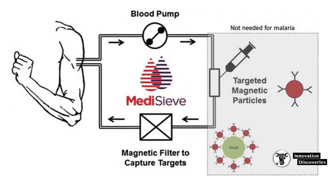 MediSieve Is A New Technology That Can Remove Diseases From The Blood Using Magnets